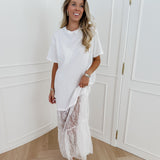 White Shirt Lace Dress